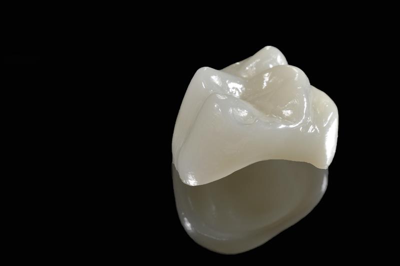 Porcelain Crowns Las Vegas, NV